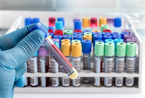 Laboratory Analyses 